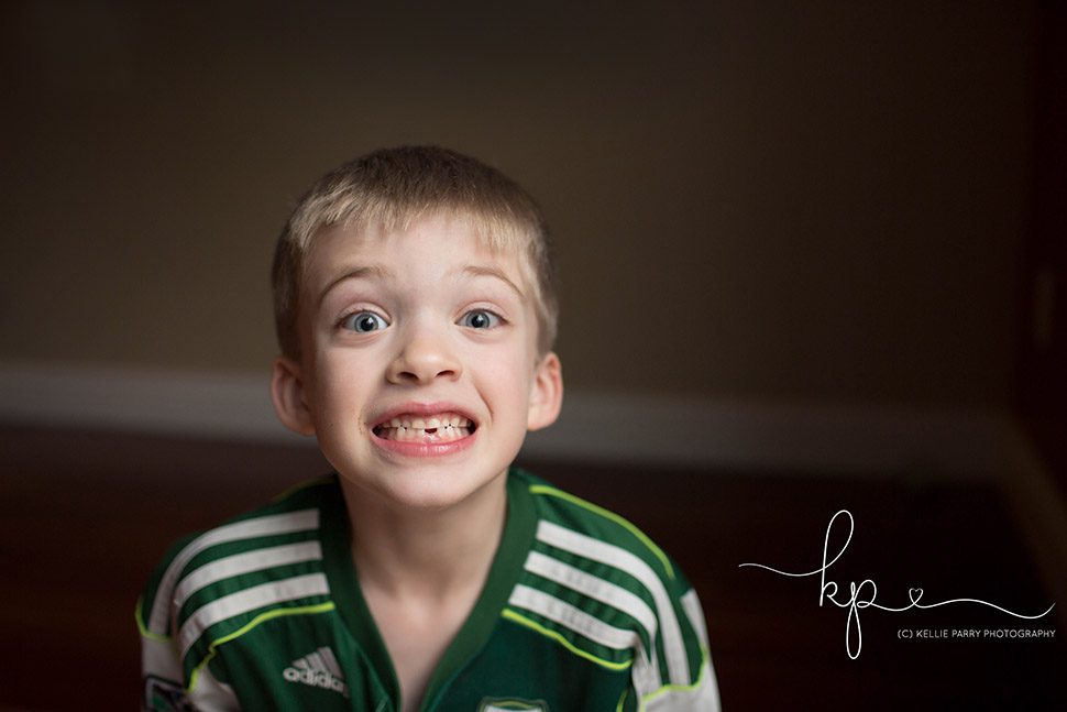 boy missing a tooth